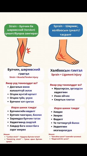 Энгийн ялгааг нэг өгүүлбэрээр * Sprain → Холбоос (ligament) гэмтэнэ. * Strain → Булчин шөрмөс (muscle/tendon) гэмтэнэ. ❇️ 1.Sprain – Шөрмөс, холбоосын суналт/тасралт Sprain = Ligament injury Ligament (холбоос) нь ясыг ясанд холбож тогтвортой байлгадаг.� Sprain нь үеэр мушгирсан, хазгай гишгэх, мултрах үед хамгийн их тохиолддог. ✅Ямар үед тохиолддог вэ? * Шагай бэхэлгээ буруу гишгэх * Унах * Эргэлттэй хөдөлгөөн хийх * Спортын гэмтэл ✅Илрэх шинж тэмдэг: * Хавдах * Хөхрөх * Өвдөлт * Үе тогтворгүй б