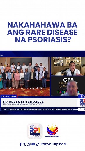 1K views | Tuwing Pebrero ay inoobserba natin ang Rare Disease Awareness Month. Sa programang #OtroCinco, ipinaliwanag ni Dr. Bryan Ko Guevarra kung ano ba ang psoriasis at binigyang diin din nito na hindi nakahahawa ang ganitong sakit. | Radyo Pilipinas | Facebook