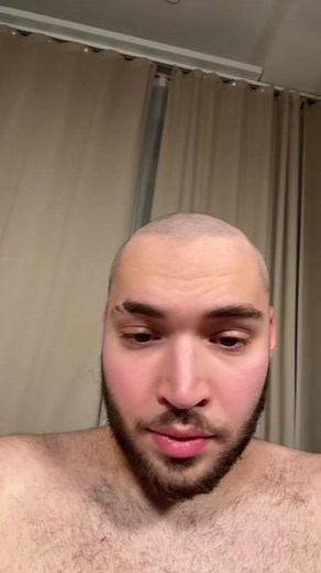 Adin Ross Bald Transformation 2023: Taking Over the World