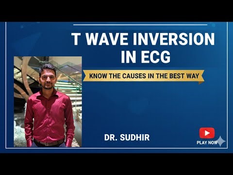 T wave inversion in ECG | know the causes in the best way | by Dr Sudhir
