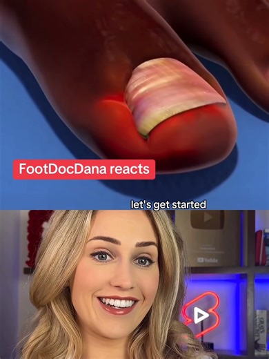 Effective Ingrown Nail Treatment Methods