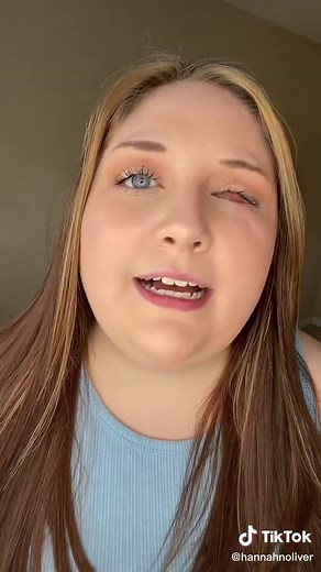 Story Time: How I Lost My Eye | Hannah Oliver Eye