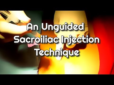 An Unguided Sacroiliac Joint Injection Technique
