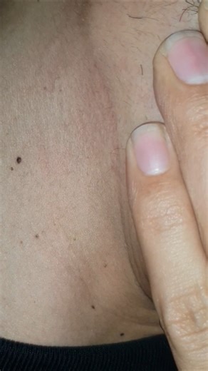 Hair massage therapy #shorts #relax #beard #haircare #asmr #satisfying #ingrownhair #hairgrowth