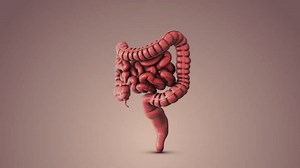Irritable bowel syndrome medical animation