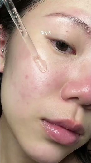 Abib Glutathiosome Dark Spot Serum | Brightening & Spot Correcting Solution for Clear Skin #beauty