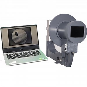 [Hot Item] Low Radiation Dose Medical Handheld Portable X Ray Machine