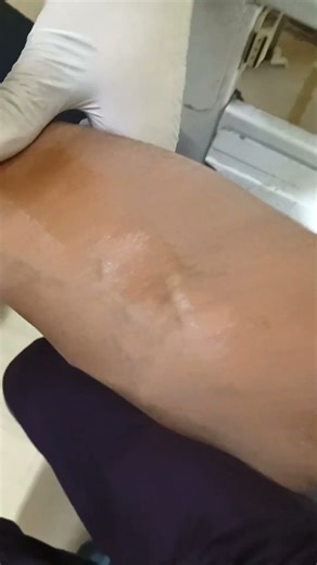 how to give IV injection #short #hospitallife #medicalstudent