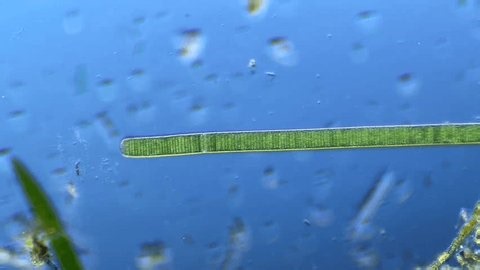 clip-3999489711-oscillatoria-other-microorganisms-under-microscope-100x ...