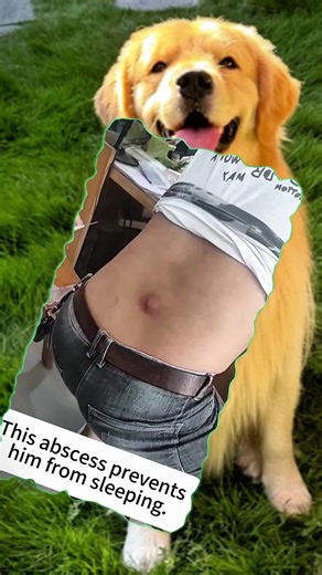 #pimple #pimples | pimple patch face mask