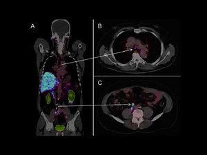 Perfect Prostate Health (Subliminal + Binaraul + Energy Field)