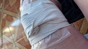 Electrotherapy. Treatment of arthrosis of the knee joint with pulsed electric current. Treatment of injuries based on the use of electrical current to stimulate muscle activity and reduce pain Stock Video