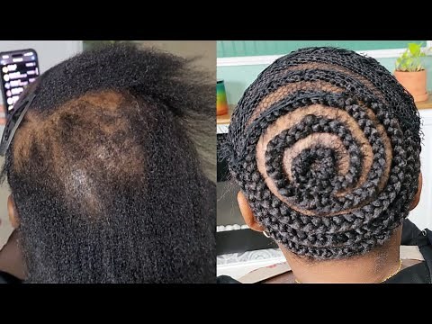 THE BEST CROCHET BRAID PATTERN FOR THINNING HAIR | Tips & Tricks For Full Hair