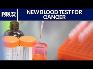 New blood test makes pancreatic cancer easier to detect