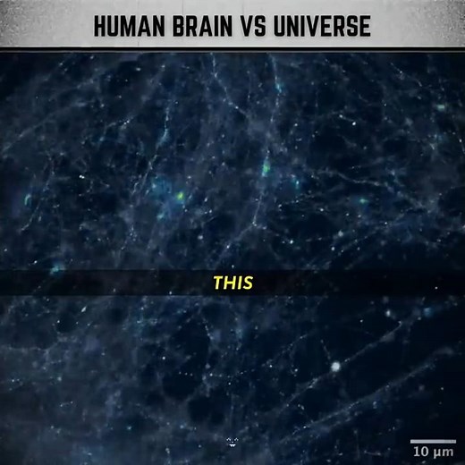 HUMAN BRAIN VS UNIVERSE 🧠🌌