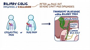 Video: Approach to biliary colic: Clinical sciences - Video Explanation! | Osmosis | Osmosis