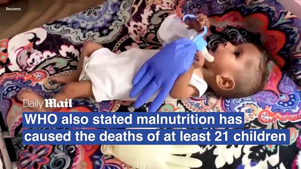 Who warns that Gaza is experiencing mass starvation