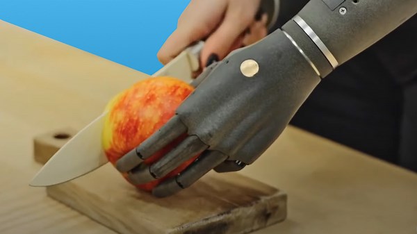 Bionics are the future of prosthetics