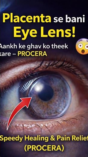 Procera Eye Healing Device | Amniotic Membrane Eye Treatment Explained 👁️✨ #eyes #optometry #shorts