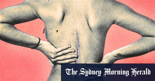 The cheaper, the better: The ‘game-changer’ scar treatment study