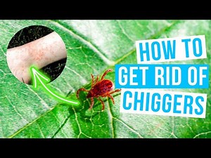 How to GET RID OF CHIGGERS in home and yard