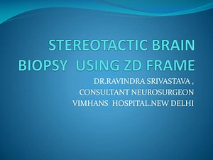 STEREOTACTIC BRAIN BIOPSY USING ZD FRAME - SlideServe