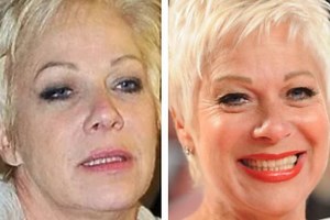 Denise Welch looks radiant eight years after giving up booze as she reveals before and after pictures