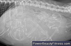 Comment Administrer Une Injection Dans Une Fesse 💪💪 Tout À Propos Des Modes De Vie Sains Et De Remise En Forme - 2025