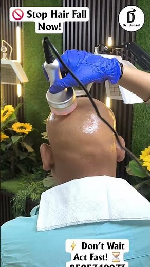 Alopecia Areata/Treatment & Recovery/Ayurveda/ haircare /Dr Bansal