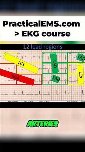 ECG Interpretation: Understanding MI Patterns & Coronary Arteries