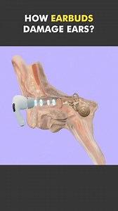 3.7K views · 22 reactions | How Earbuds Damage Your Ears? #earbuds #ear #eardamage #eardamagewarning #tinnitus #tinnitusawareness #hearinglossprevention #hearinglossawareness #hearingloss #medical3danimation #3dmedicalanimation | Mix Dancing Events | Facebook