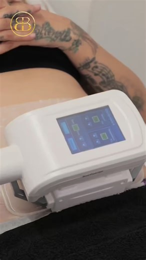 Body Boutique on Instagram: "Fat Freezing - What actually happens when we freeze fat cells “Freeze fat” sounds dramatic - but what really happens under your skin? ❄️ In this video, Grace explains the real science behind fat freezing, how your body naturally clears those fat cells, and why hydration + movement are key to results. No gimmicks, no overnight promises, just facts that help you understand your body better. 💬 Curious about fat freezing? Comment READY below and we’ll send you our Free 