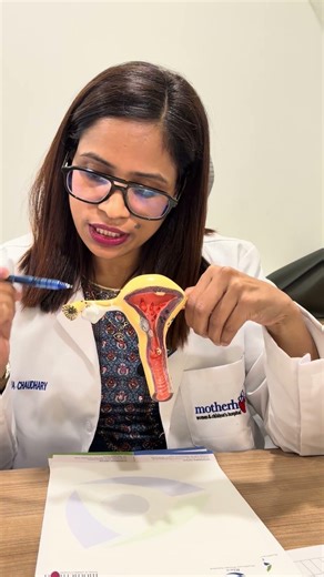 HSG Test Truth ❌ Myths va Reality- Every Women Must Know #fertilitytest #fertilityawareness #hSGtest