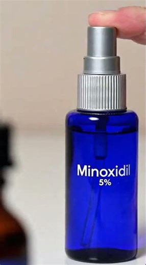 androgenetic alopecia