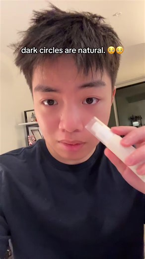 Eliminar las ojeras de forma efectiva