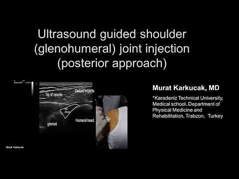 Ultrasound guided shoulder (glenohumeral) joint injection (posterior approach)