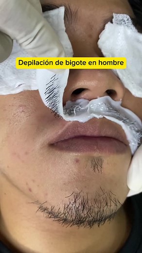 #waxing #puebla #depilacion #fyp #parati