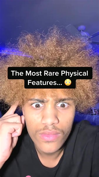 The Most Rare Physical Features… 😳 #fyp #xyzbca #viral #fypシ #foryoupage | Truecrimetok