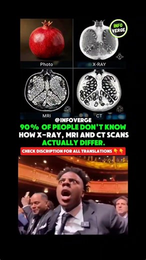 xray vs mri vs ct scan difference explained in seconds shocking truth #health #xray #mri #ctscan