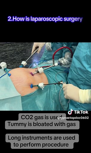 Laparoscopic Surgery Explained: Benefits and Procedures