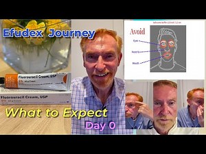 Efudex Treatment 2025 – My Honest Day 0 (What to Expect)