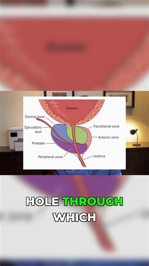 Donut-Shaped Prostate: Understanding BPH
