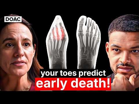 The Foot Expert: Your Toes Can Predict If You’ll Die Early! This Will Fix Plantar Fasciitis!