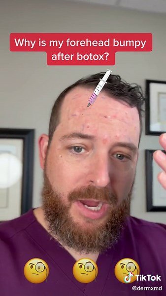 Understanding Bumps After Botox Injections