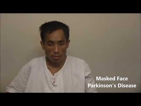 Masked Face in Parkinson's Disease | Dr. Paresh Doshi