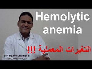 Laboratory findings in hemolytic anemia (Arabic) !!!