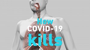 COVID-19 attacks the lungs and can cause serious infections, but what exactly is happening that causes people to die? CGTN takes a look inside the human body to show you how the virus affects the lungs on a cellular level, and how COVID-19 eventually kills. | CGTN