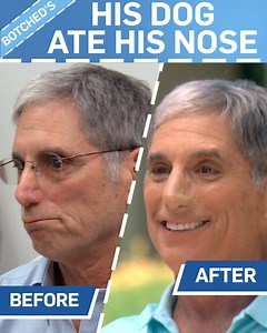 Last night, Dr. Nassif was faced with one of his hardest cases yet! | Botched