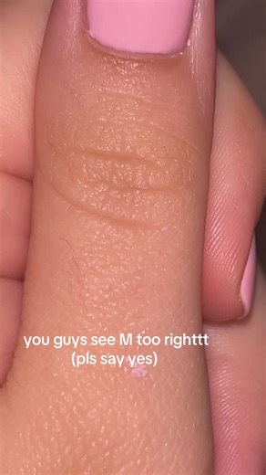 m for MAN. why do i have hair on my knuckle. #initial | initial on the thumb