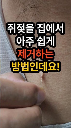 쥐젖을 집에서 아주 쉽게 제거하는 방법인데요. 쥐젖 제거 #쥐젖 #쥐젖제거 #쥐젖실로제거